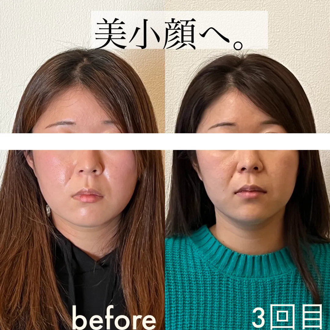 ビフォーアフター