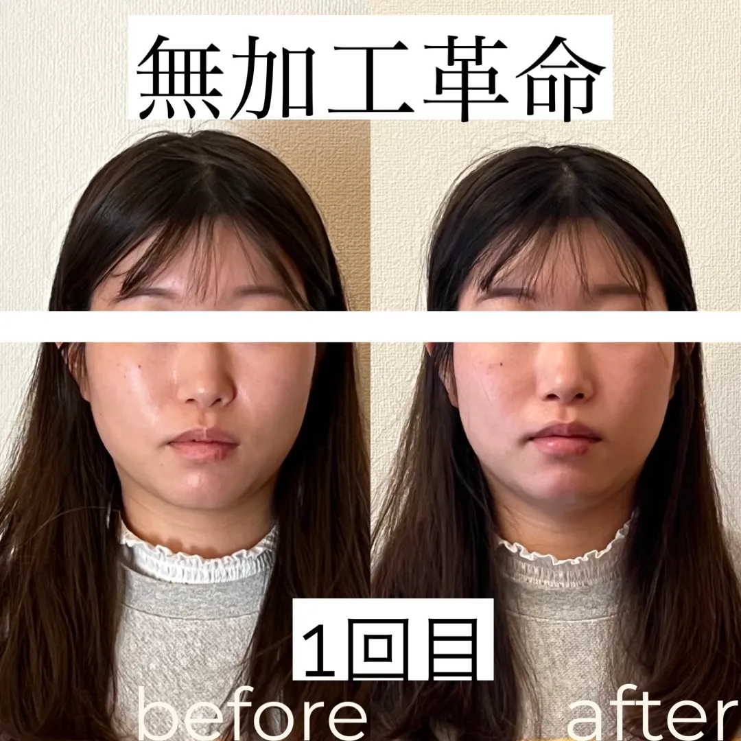 ブライダルを控えたお客様。