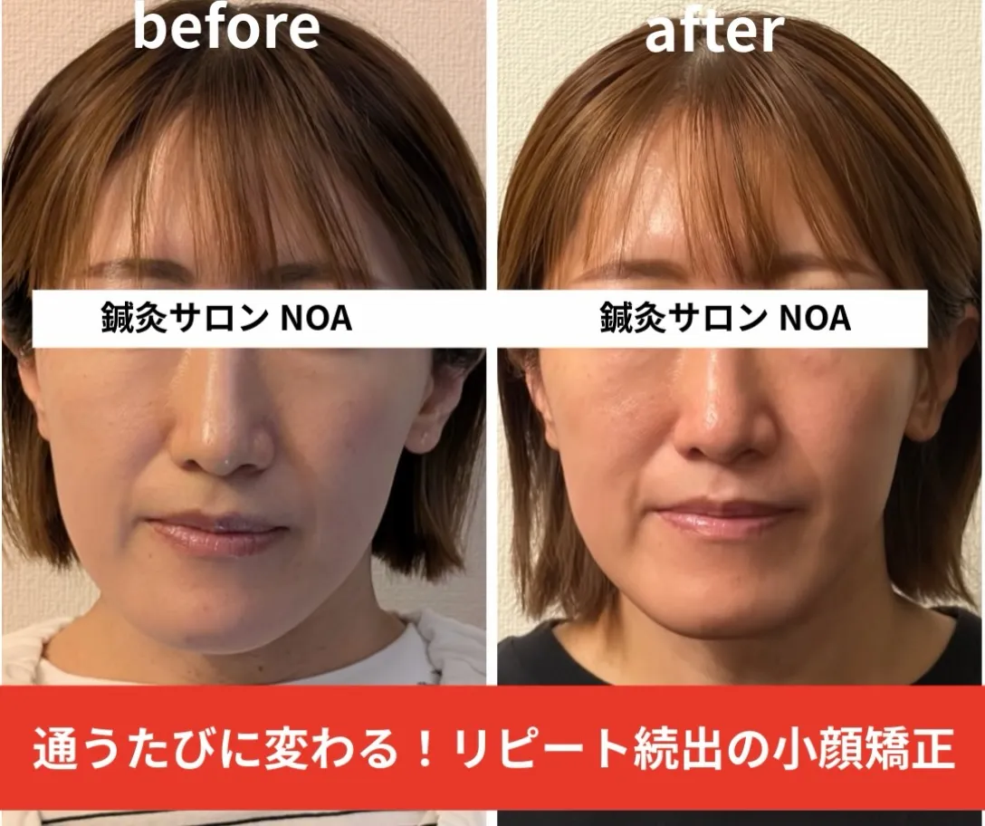 県内のリピーター様のお施術ビフォーアフターです✨