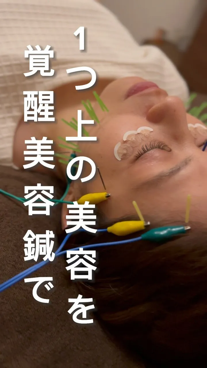 前橋美容鍼　施術風景