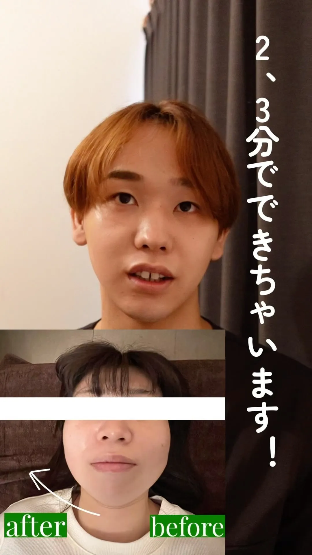 （高崎小顔矯正）リフトアップにはシンクロ波（特殊な電気）！